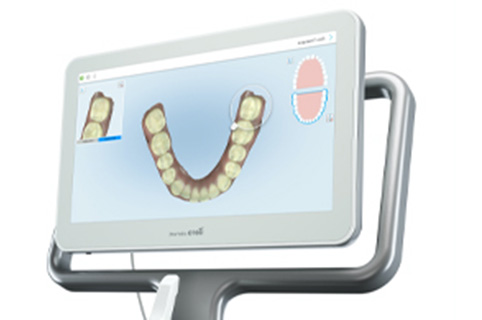 お口の中のスキャン･治療方針･見積もりなど